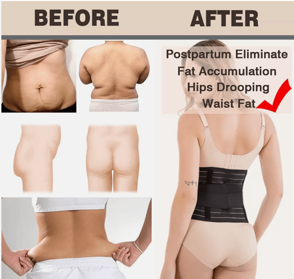 Baby-Bump™ Postpartum Postnatal Abdominal Support Belly Belt After Pregnancy Wrap